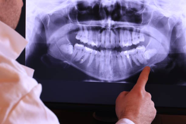 Best Emergency Broken Tooth Repair in Groveland, ID