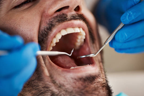 Best Emergency Broken Tooth Repair in Groveland, ID