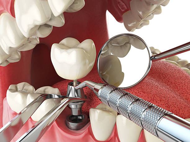 Best Walk-In Emergency Dentist in Groveland, ID